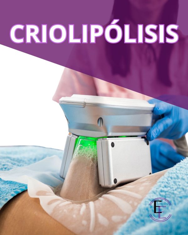 CRIOLIPÓLISIS 1, 2, 4, 6 o 9 POSTURAS