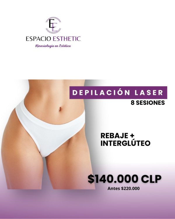 Depilación Láser en Rebaje e Interglúteo