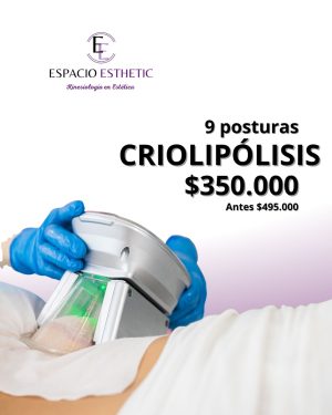 Criolipólisis 9 Posturas