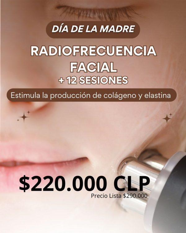Promoción Día de la Madre | Radiofrecuencia Facial (12 Sesiones)
