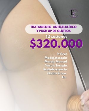 Tratamiento Levantamiento Glúteo ó Anticelulítico