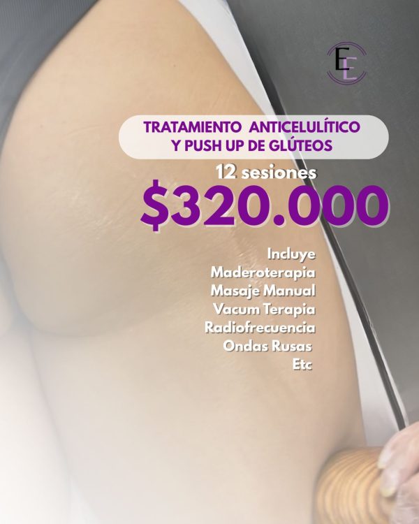 Agregar un título (Post de Instagram (45)) Tratamiento Levantamiento Glúteo ó Anticelulítico