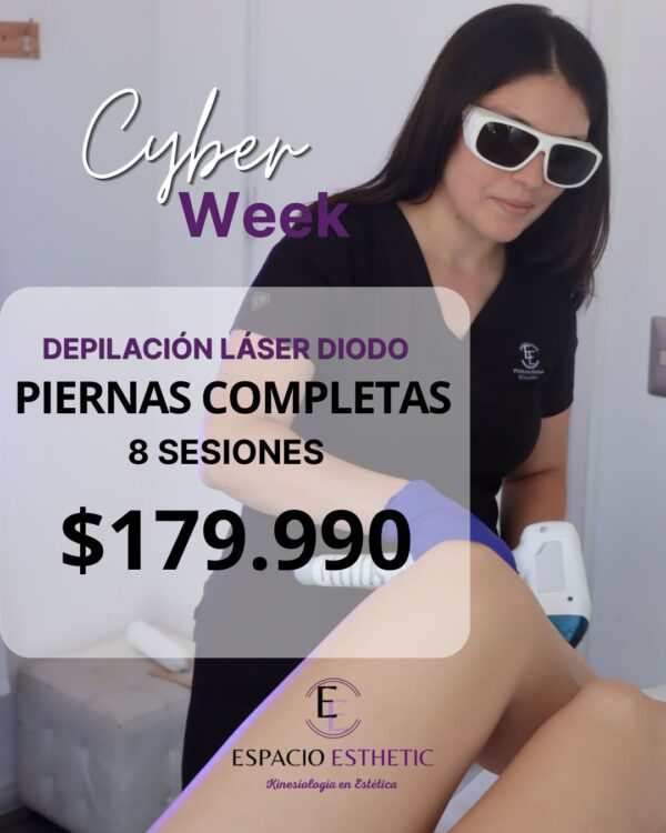 Cyber Week Depilación Piernas Completas