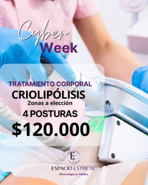 Cyber Week 4 Posturas de Criolipólisis