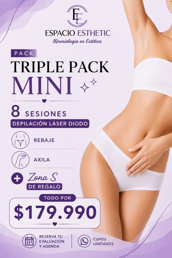 Triple Pack Mini - Promoción Flash